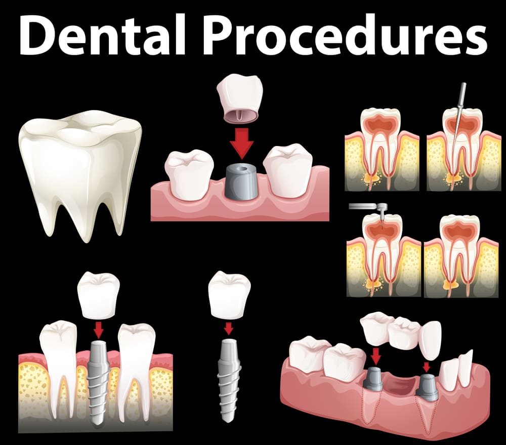 dental problems and treatment